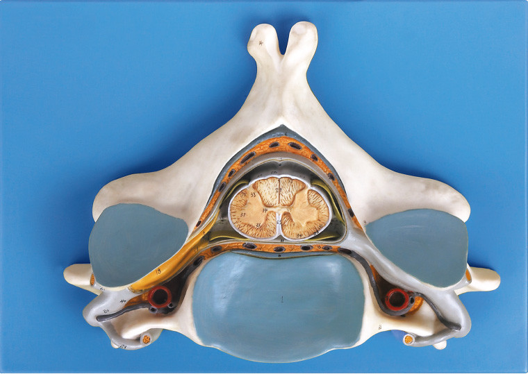 Πέμπτο αυχενικό Vertrebra με το νωτιαίο μυελό και το ανατομικό ανθρώπινο πρότυπο σκελετών νεύρων