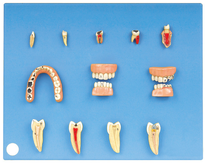 Οδοντικό πρότυπο ασθενειών φιαγμένο από προηγμένο PVC για το οικοτροφείο και την κατάρτιση σπουδαστών