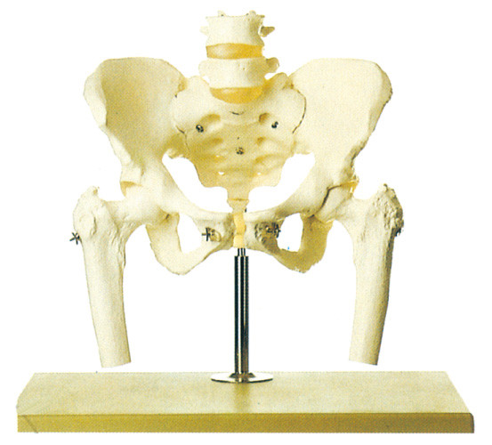 Λεκάνη με την οσφυική σπονδυλική στήλη και το μηριαίο επικεφαλής ανθρώπινο πρότυπο σκελετών stander