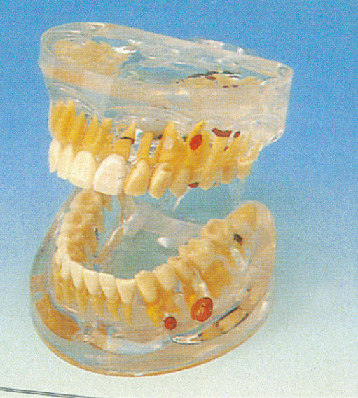 Ενήλικο διαφανές οδοντικό πρότυπο δοντιών παθολογίας ανθρώπινο για την κατάρτιση κολλεγίων