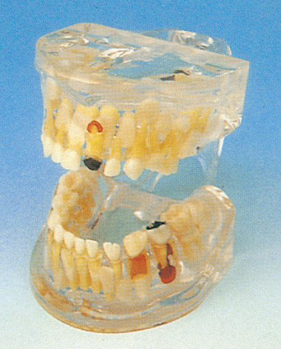 Η ανθρώπινη πρότυπη/φωτεινή παθολογία δοντιών των δοντιών γάλακτος διαμορφώνει για την οδοντική σχολική κατάρτιση