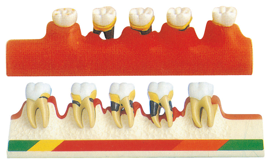 Το περιοδοντικό πρότυπο ασθενειών περιλαμβάνει 5 μέρη για την οδοντική σχολική κατάρτιση