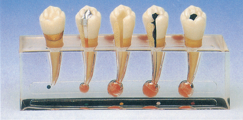 Το κλινικό πρότυπο παθολογίας Endodontics περιλαμβάνει 5 μέρη για την κατάρτιση κλινικών