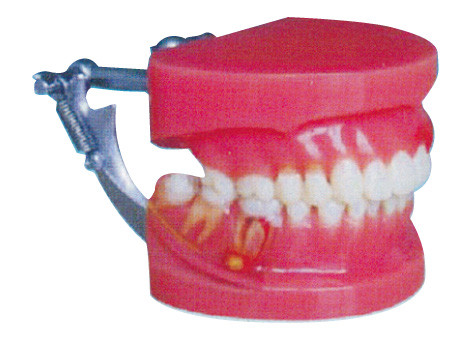 Κόκκινος και λευκός περιοδοντικός ασθενειών πρότυπος γενικός γιατρός δοντιών επίδειξης ανθρώπινος