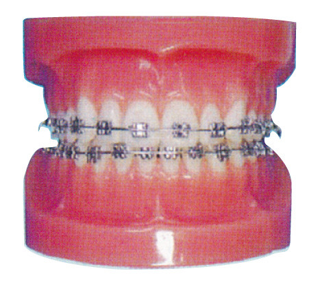 Orthodontic ανθρώπινο πρότυπο δοντιών για τα νοσοκομεία και την οδοντική κατάρτιση νοσοκομείων
