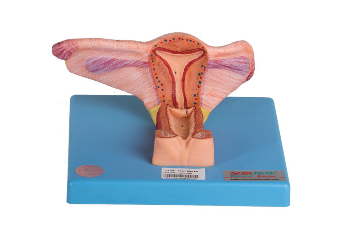 Το θηλυκό εσωτερικό γεννητικό πρότυπο οργάνων παρουσιάζει στεφανιαίο τμήμα της ωοθήκης και του ουρητήρα