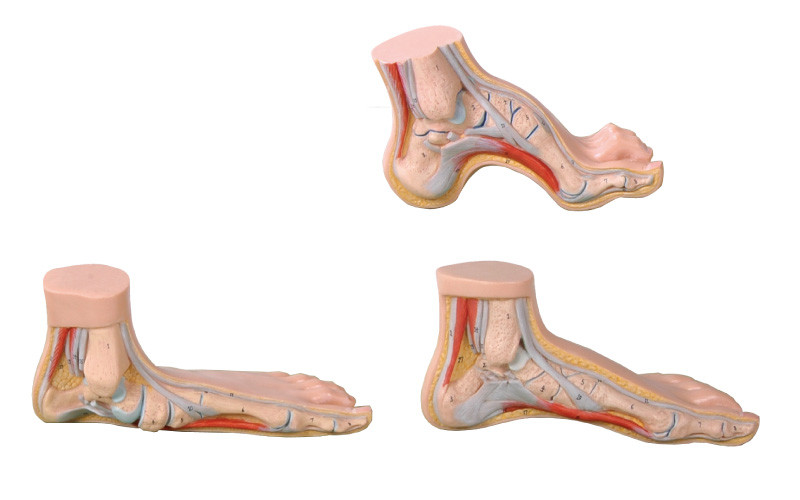 Κανονική, επίπεδη, σχηματισμένη αψίδα πρότυπη ζωή ανατομίας ποδιών ανθρώπινη - ταξινομήστε το ιατρικό εργαλείο