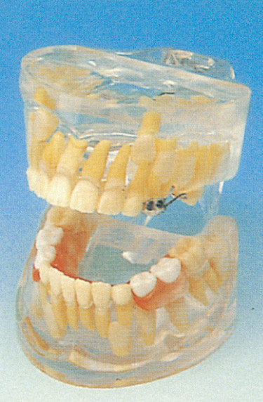 Οδοντικό πρότυπο ανάπτυξης δοντιών γάλακτος σχολικών ανθρώπινο δοντιών πρότυπο/διαφανές