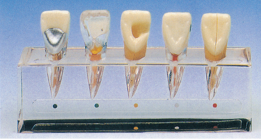 Κλινικό πρότυπο σειράς ασθενειών δοντιών για 5 μέρη για την οδοντική σχολική κατάρτιση