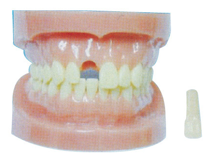 Αποσπάσιμο πρότυπο δοντιών χωρίς ρίζα για τα νοσοκομεία και την οδοντική κατάρτιση πρόληψης