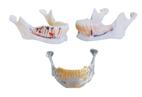 Τα δόντια οδοντιάτρων διαμορφώνουν το κάτω γναθιαίο πρότυπο με τα νεύρα, τις αρτηρίες και τις φλέβες