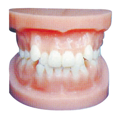 Οδοντικά πρότυπα μοσχευμάτων/Orthodontic πρότυπο για την ανατομική κατάρτιση