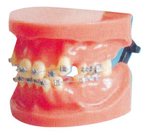 Η εξάρθρωση καθόρισε το Orthodontic πρότυπο για το ιατρικό κολλέγιο και την οδοντική κατάρτιση νοσοκομείων